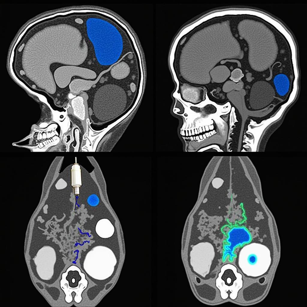 Hình ảnh CT scan có dùng thuốc tương phản